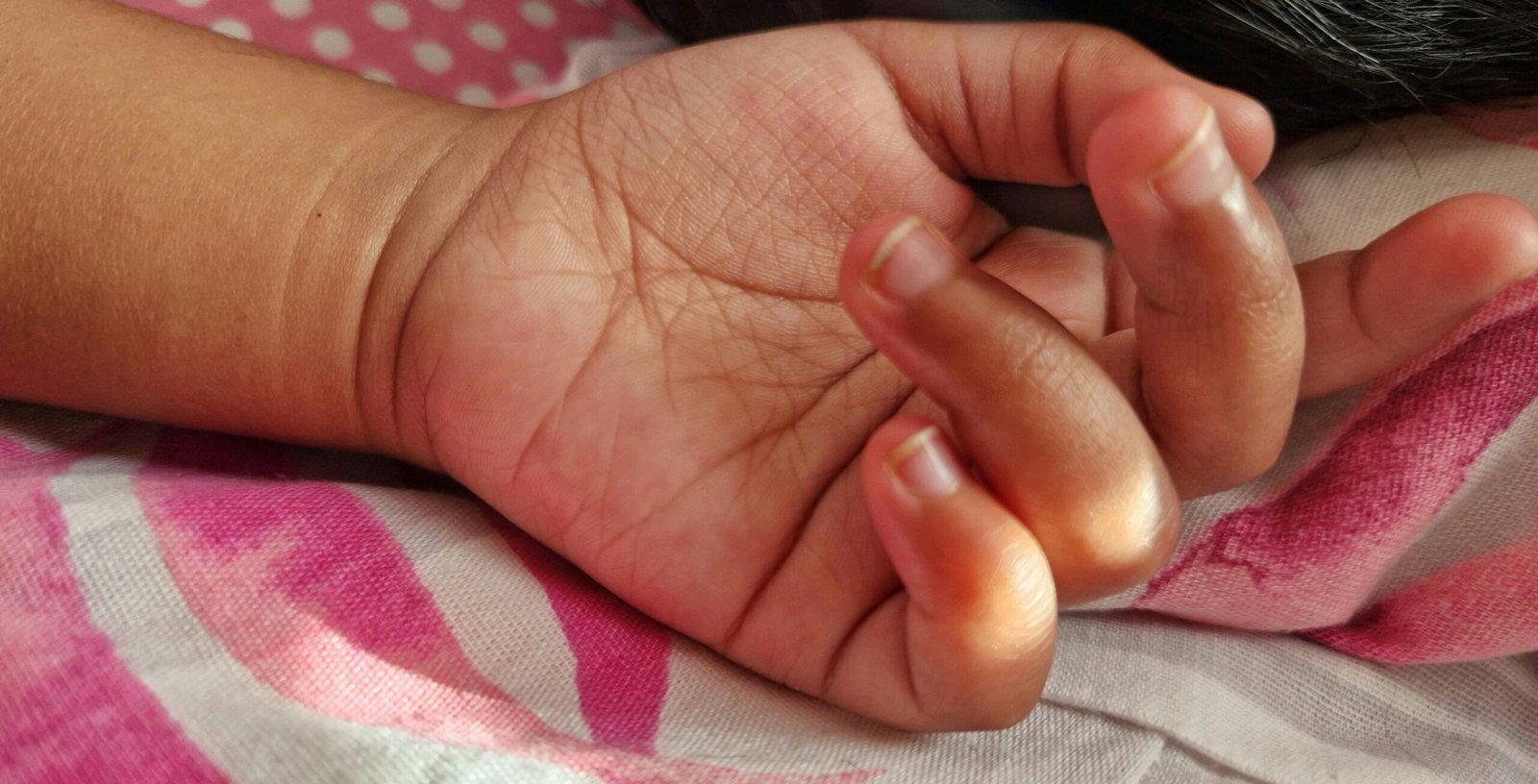 Maladie pieds-mains-bouche : les signes à reconnaître chez l’enfant et les situations qui doivent alerter